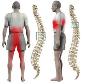 Protrusions in the spine